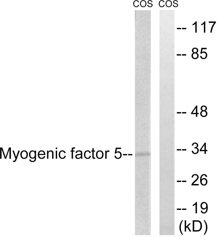 Polyclonal Rabbit anti-Human MYF5 / MYF 5 Antibody (aa21-70, IHC, IF, WB)