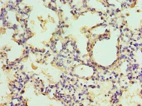 EGLN1 / PHD2 Antibody (aa301-426)