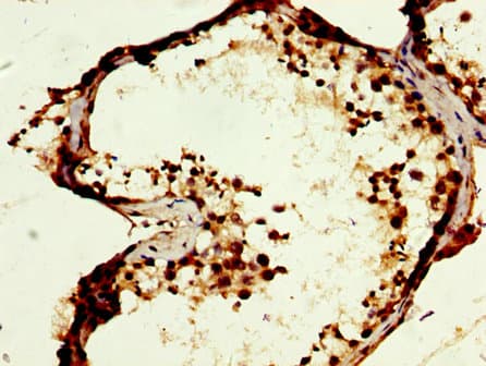 Polyclonal Rabbit anti-Human MOS Antibody (IHC, WB)