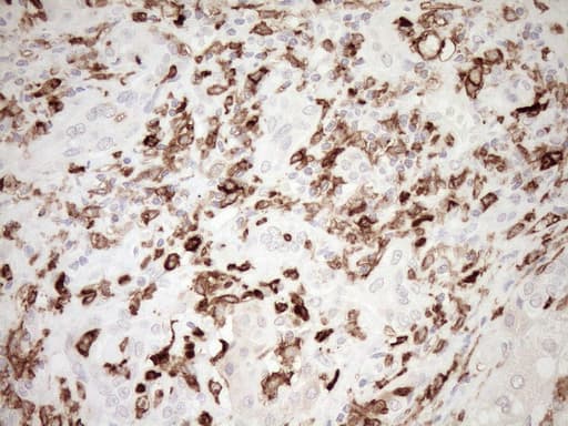 Monoclonal Mouse anti-Human ITGAM / CD11b Antibody (clone OTI2D11, IHC, WB)