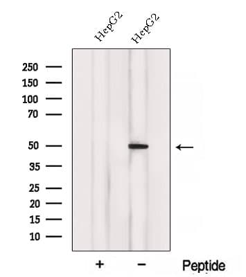 Polyclonal Rabbit anti-Human ACADL Antibody (WB)