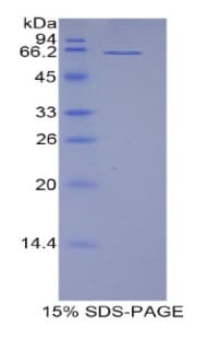 Mouse AIM / CD5L Protein (Recombinant His-GST)