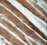 Polyclonal Rabbit anti-Human CCDC38 Antibody (aa352-380, IHC, WB)