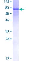 Human ERCC6L / FLJ20105 Protein (Recombinant GST)