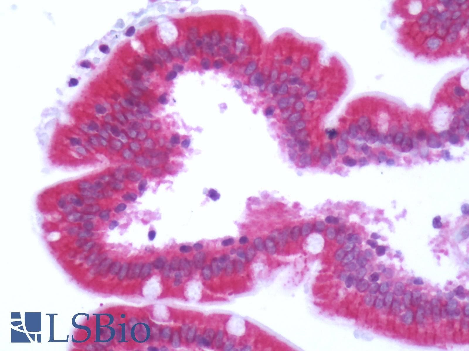 IHC-plus™ Polyclonal Rabbit anti-Human FAP Alpha Antibody (Extracellular Domain, IHC)