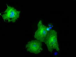 PKLR Antibody (clone OTI1F3)