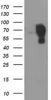 IHC-plus™ Monoclonal Mouse anti-Human MAC-2-BP / LGALS3BP Antibody (clone 3D6, IHC, IF, WB)