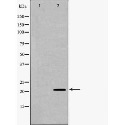 UBE2M / UBC12 Antibody