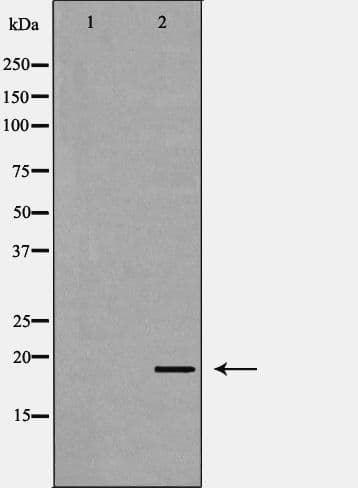 IL-10 Antibody