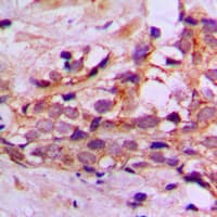 Polyclonal Rabbit anti-Human DYNLL2 Antibody (N-Terminus, IHC, WB)