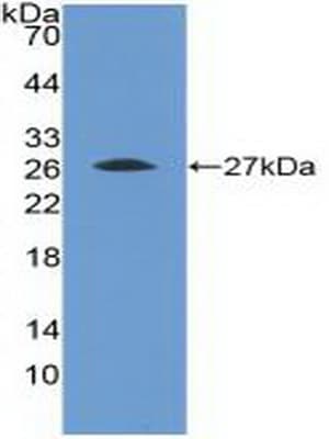 FGFR4 Antibody (aa168-369, Cy3)