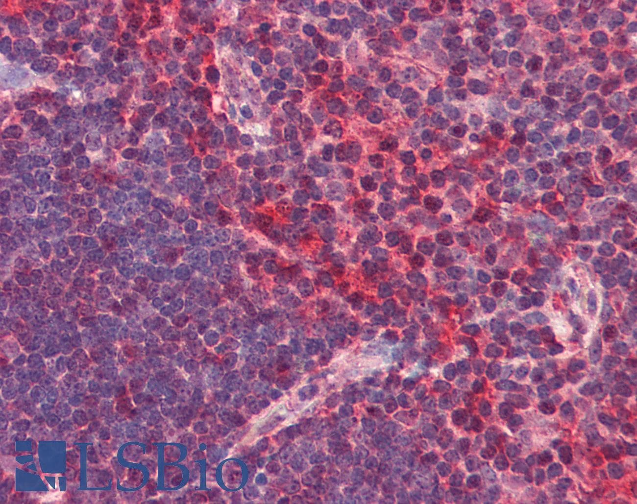IHC-plus™ Polyclonal Rabbit anti-Human CXCR6 Antibody (IHC, IF, WB)