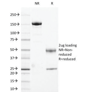 Monoclonal Mouse anti-Human HLA-DR Antibody (clone 169-1B5.2, Ready-to-Use, IHC, IF)