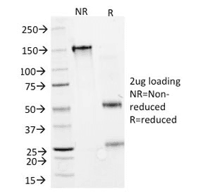 GAD1 / GAD67 Antibody (clone GAD1/2391)