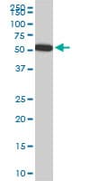 FGL2 Antibody (clone 6D9)