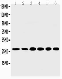 Polyclonal Rabbit anti-Human SHH / Sonic Hedgehog Antibody (aa203-218, IHC, WB)