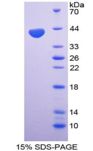 Human CCL4 / MIP-1 Beta Protein (Recombinant His-GST)