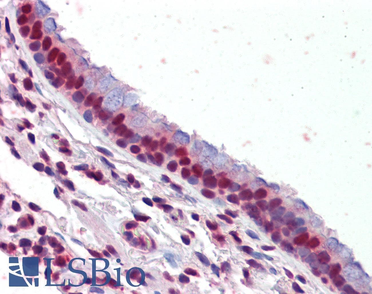 IHC-plus™ Polyclonal Rabbit anti-Human PRMT1 Antibody (aa316-347, IHC, WB)