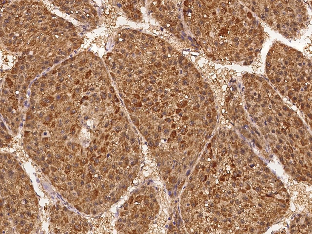 Polyclonal Rabbit anti-Human ABCG5 Antibody (IHC)