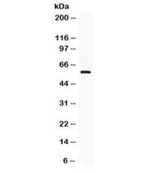 IKZF1 / IKAROS Antibody