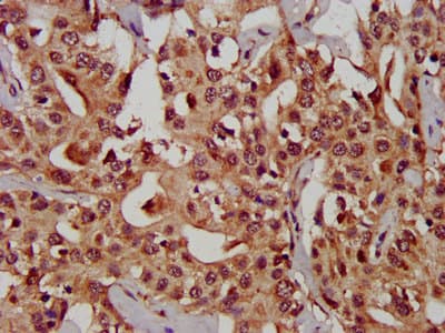Polyclonal Rabbit anti-Human CHST11 Antibody (IHC)