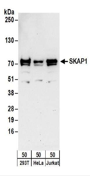 SKAP1 / SCAP1 Antibody (aa125-175)