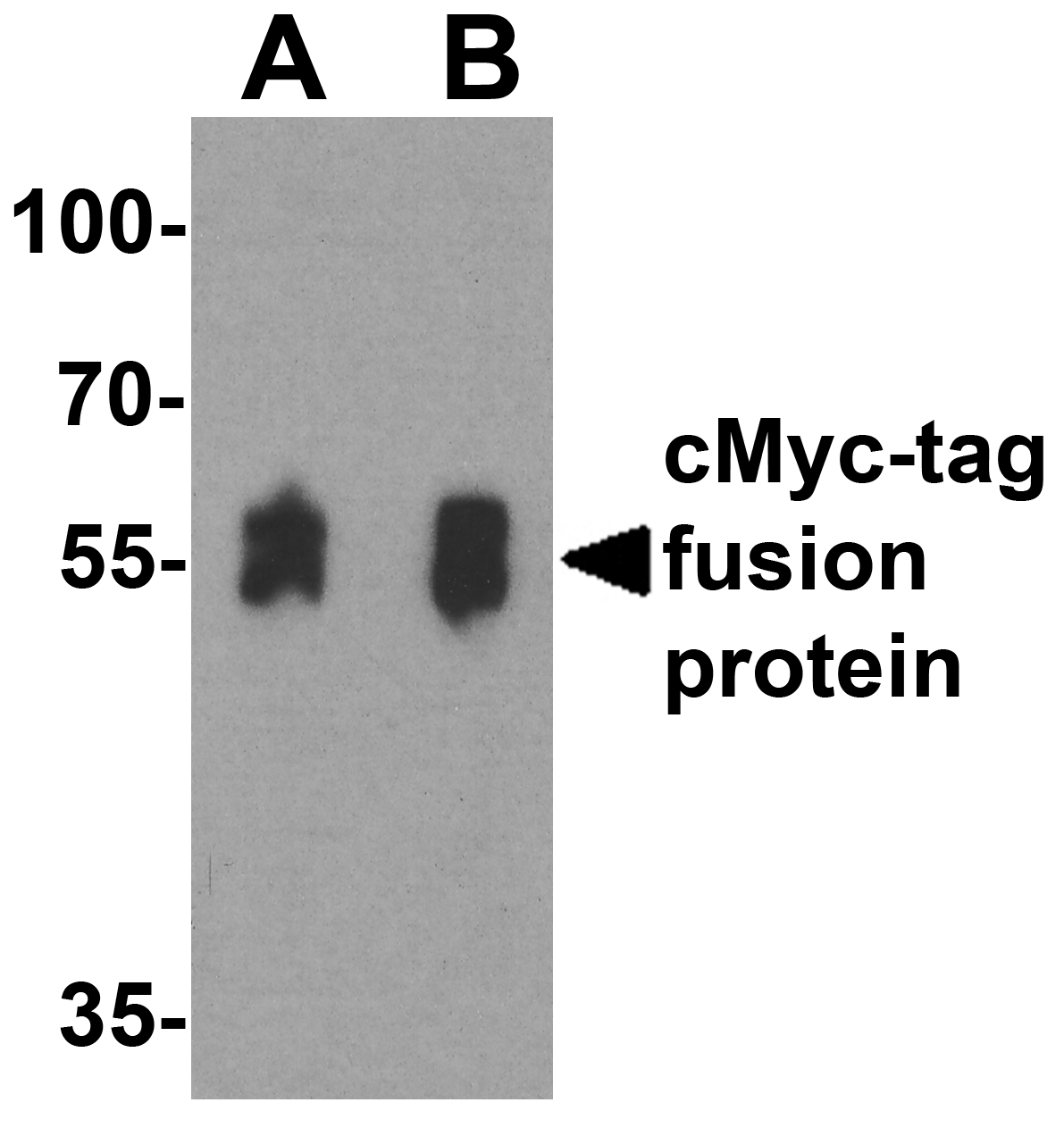 Myc Tag Antibody