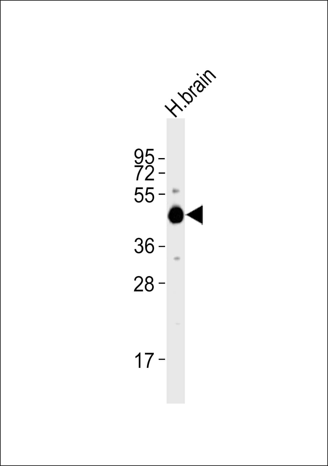 Polyclonal Rabbit anti-Human HTR1A / 5-HT1A Receptor Antibody (WB)