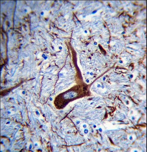 Monoclonal Mouse anti-Human MAP2 Antibody (IHC, IF, WB)