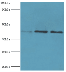 APOL1 / Apolipoprotein L Antibody (aa179-398)