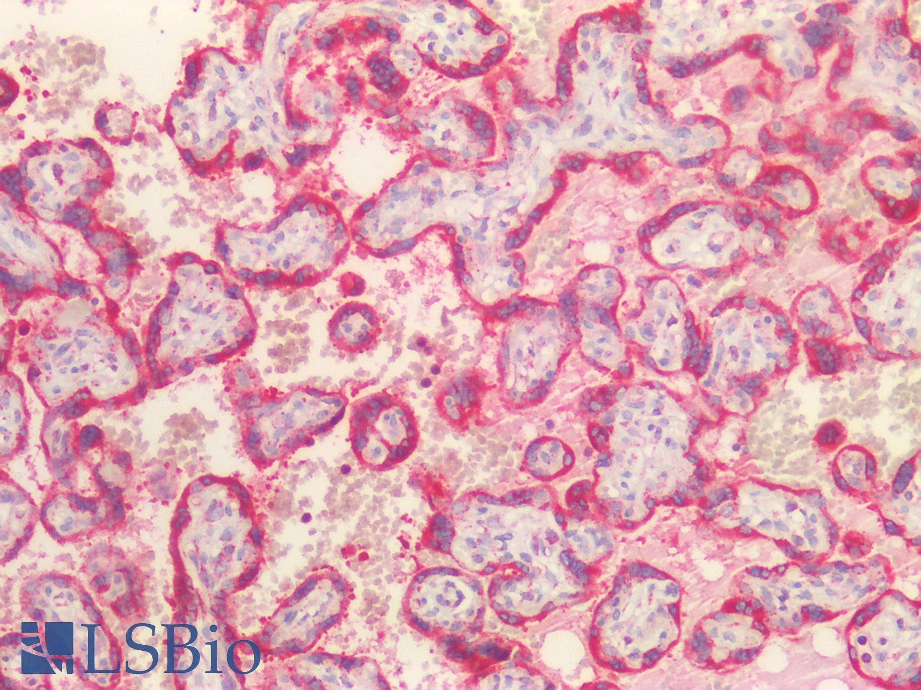 IHC-plus™ Polyclonal Rabbit anti-Human HSP90B1 / GP96 / GRP94 Antibody (aa16-43, IHC, IF, WB)