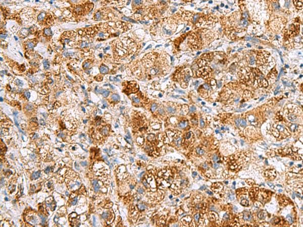 NMU / Neuromedin U Antibody