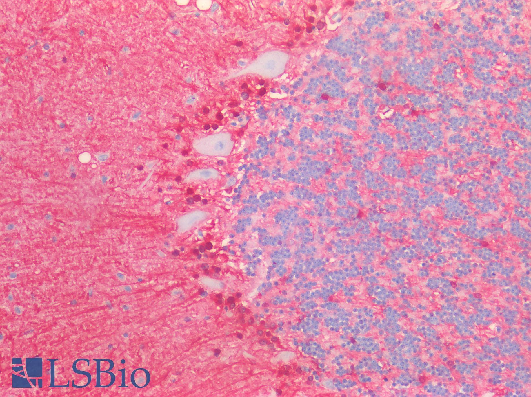 PathPlus™ Polyclonal Goat anti-Human S100B / S100 Beta Antibody (Internal Region, IHC, WB)