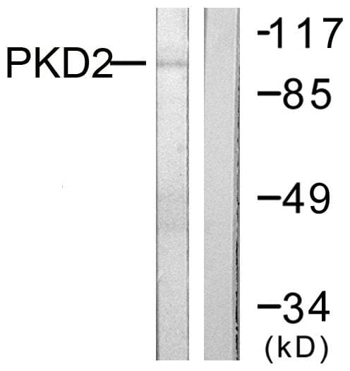 PRKD2 / PKD2 Antibody (p876)