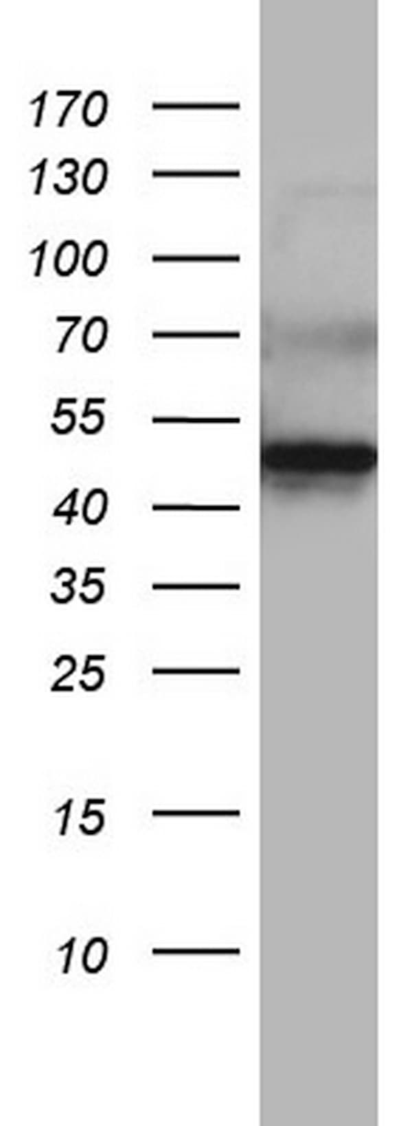 DDOST / OST48 Antibody (aa131-378, clone OTI1C1)