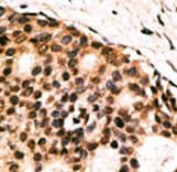 CDX1 Antibody (aa236-265)