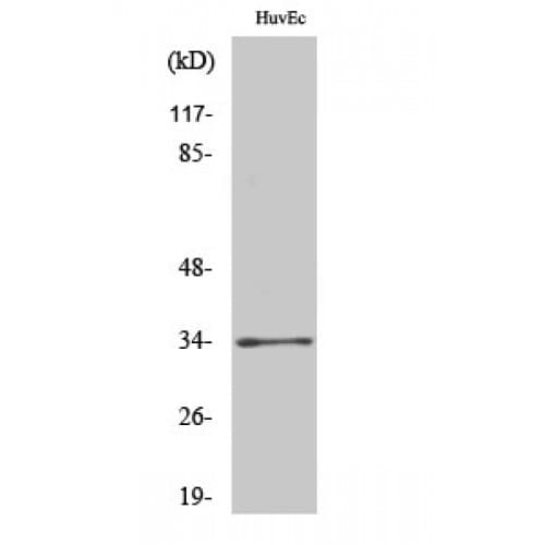 OR2T2 + OR2T35 Antibody (30-110 aa, Internal)