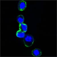 ERBB3 / HER3 Antibody (clone 2F9)