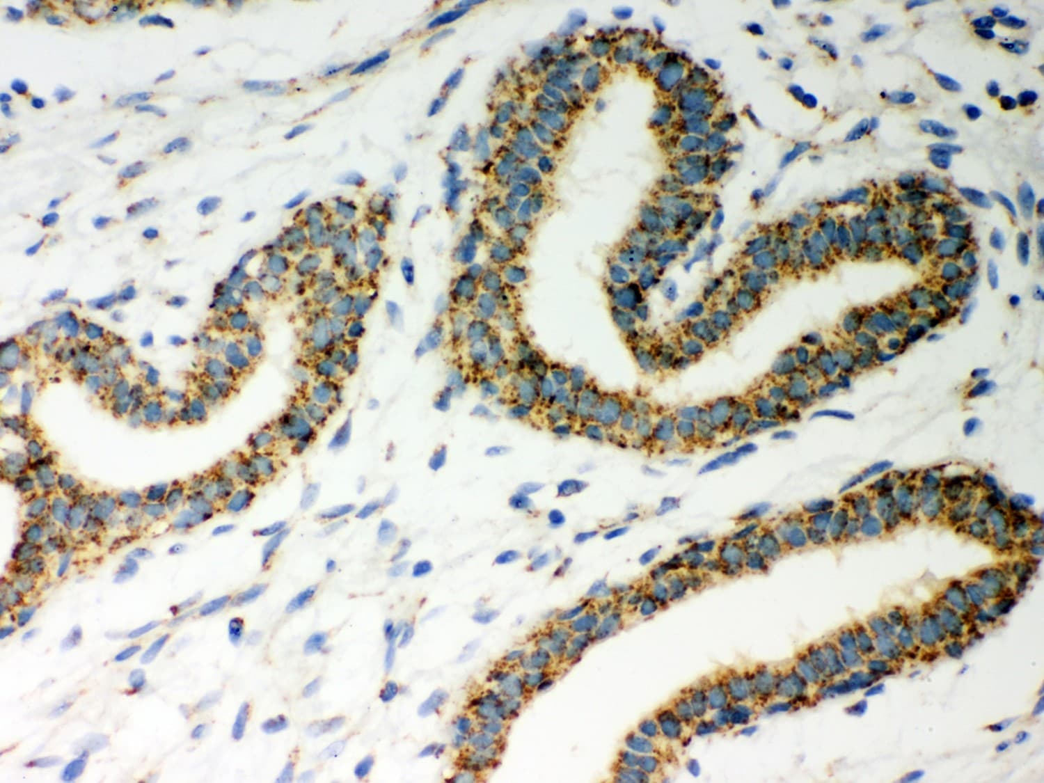 HSD17B10 / HADH2 Antibody (aa48-261)