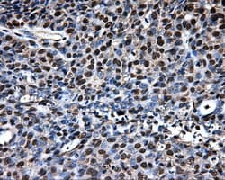 LOX / Lysyl Oxidase Antibody (clone OTI9G6)