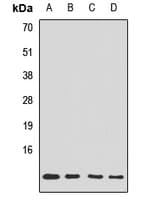 Polyclonal Rabbit anti-Human TIMM10 Antibody (WB)