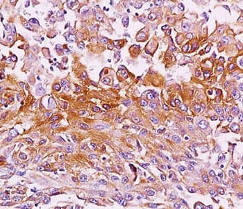 Monoclonal Mouse anti-Human PMEL / SILV / gp100 Antibody (clone NKI-beteb, Azide-free,BSA-free, IHC, IF)