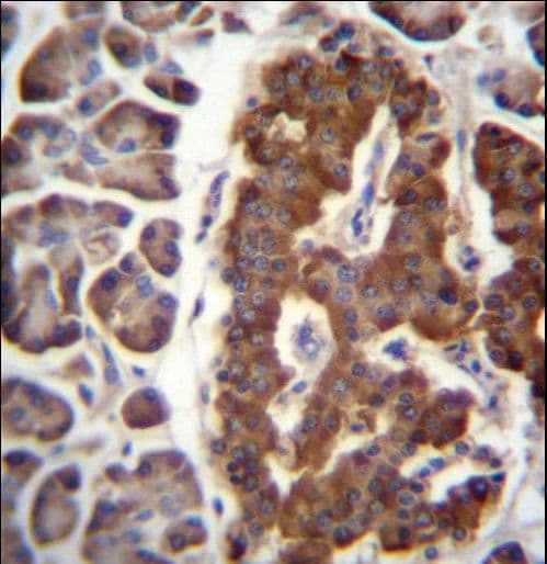 Dermatopontin / DPT Antibody (aa45-72)