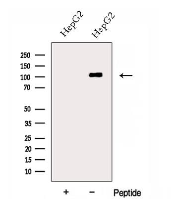 SART2 / DSE Antibody