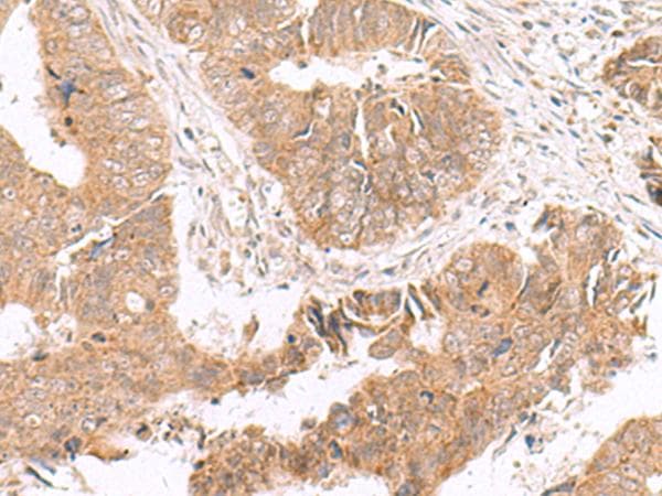 Polyclonal Rabbit anti-Human HMGCLL1 Antibody (IHC, WB)