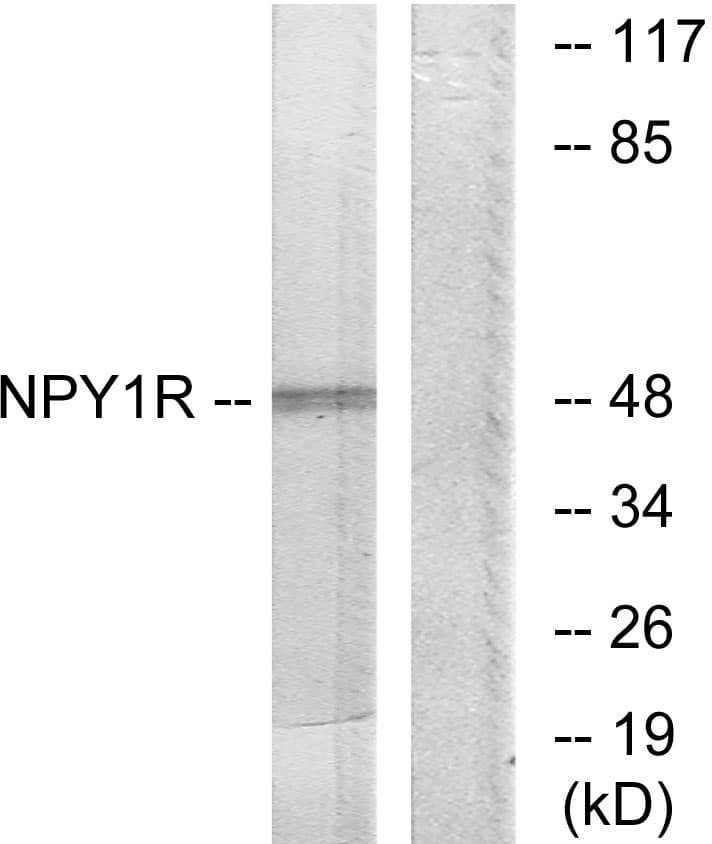 NPY1R Antibody (aa221-270)