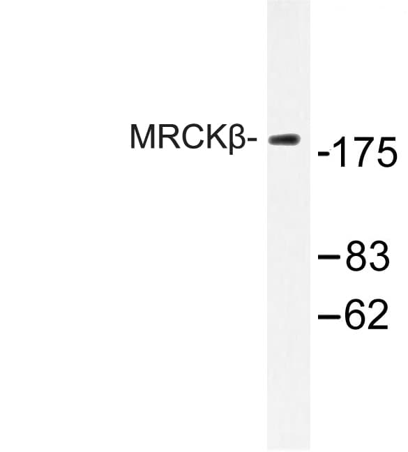 IHC-plus™ Polyclonal Rabbit anti-Human CDC42BPB / MRCKB Antibody (Phe1665, IHC, WB)