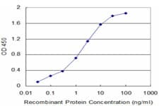 USP9X / FAM Antibody (clone 5H4)