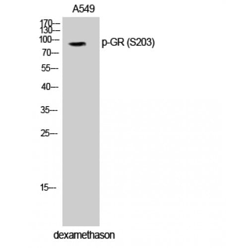 Polyclonal Rabbit anti-Human NR3C1/Glucocorticoid Receptor Antibody (140-220 aa, WB)