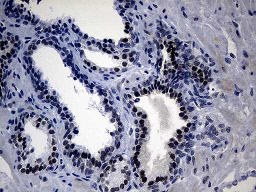Monoclonal Mouse anti-Human UPRT Antibody (clone OTI1D11, IHC, WB)